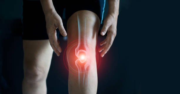 Le CBD et la gestion des symptômes de l'arthrose - HerBeevor